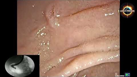 7th hands on ERCP Course | Advanced Endoscopy & Health Videos | Colonoscopy, Gastroscopy & More