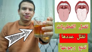 الحل النهائي للفطريات | 10 طرق سحريه تقضي علي فطريات الفم و اللسان خلال ايام