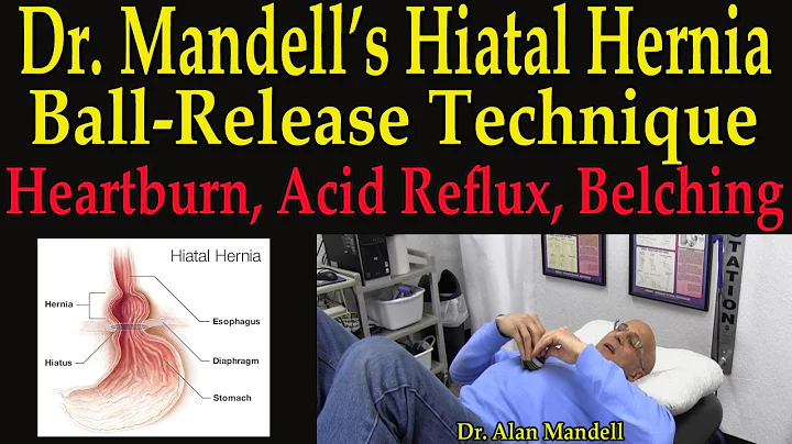 Dr. Mandell's Hiatal Hernia Ball-Release Technique...