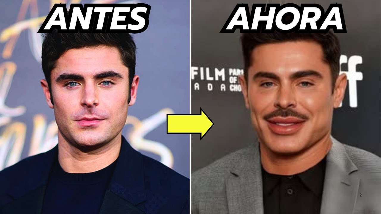 20 Estrellas De Hollywood Que Están Irreconocibles Hoy - INCREÍBLE