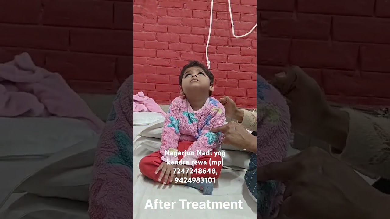 Cp child neck holding Treatment...  