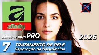 AFFINITY 3.0 - TRATAMENTO PELE COM SEPARAÇÃO DE FREQUÊNCIAS