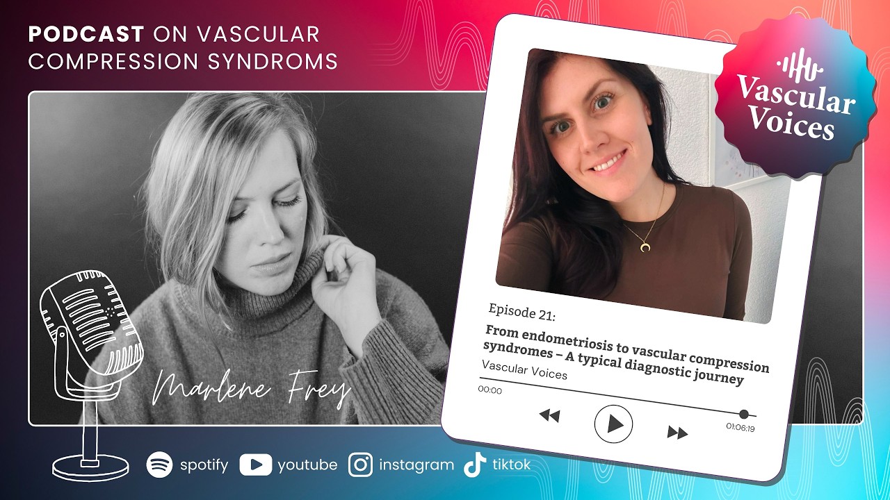 VASCULAR VOICES: Erst Endometriose, dann Gefäßkompressionen – Ein typischer Diagnoseweg