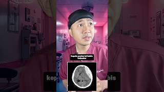Trauma Kepala  dokter koas medicalstudent ctscan traumakepala