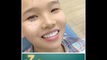 THẨM MỸ RĂNG SỨ - KIẾN TẠO NỤ CƯỜI