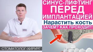 Синус-лифтинг - наращивание костной ткани перед имплантацией зубов. Установка зубных имплантов.