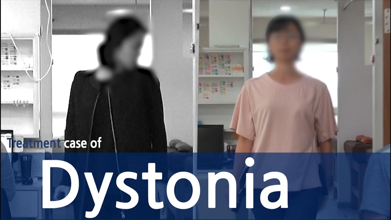 Cervical Dystonia / Dystonia / Spasmodic Torticollis / 사경증 치료사례 / 근긴장이상증