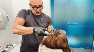 PROJECTILE SCALP CYST!