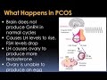 Understanding Polycystic Ovary Syndrome Video – Brigham and Women’s Hospital