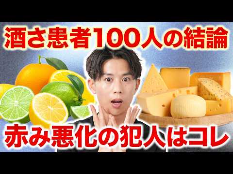 [Survey of 100 Patients] The Culprit Behind Rosacea & Redness: Foods That Make Your Skin Worse