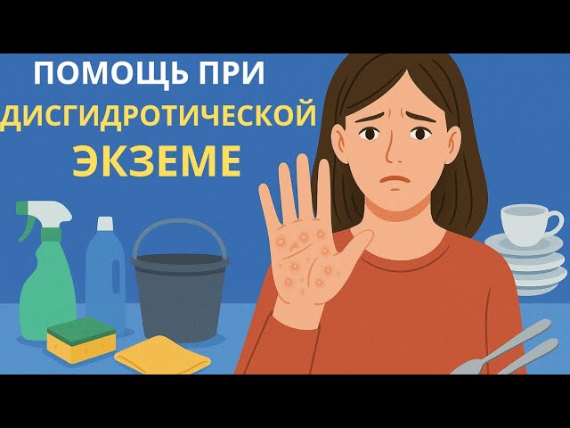 ТОП – помощников при ДИСГИДРОТИЧЕСКОЙ ЭКЗЕМЕ. Пузырьки на руках и ногах.