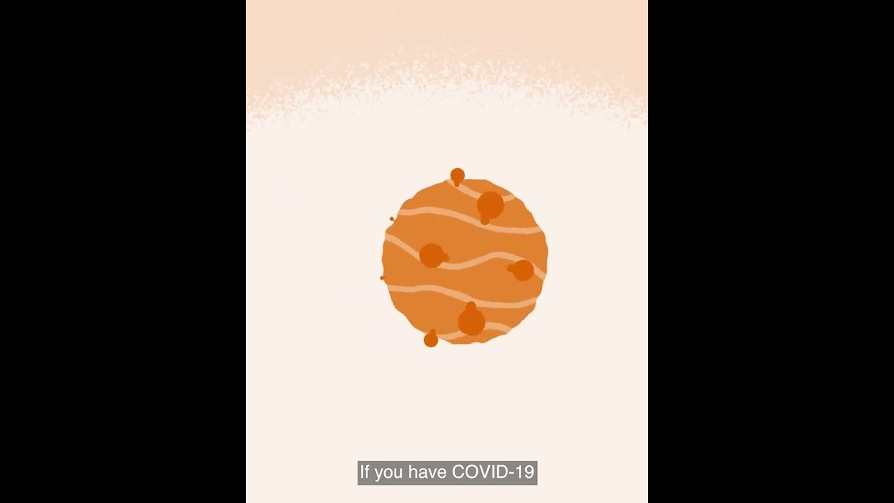 What you should do if you test positive to COVID-19 (Yulparija)