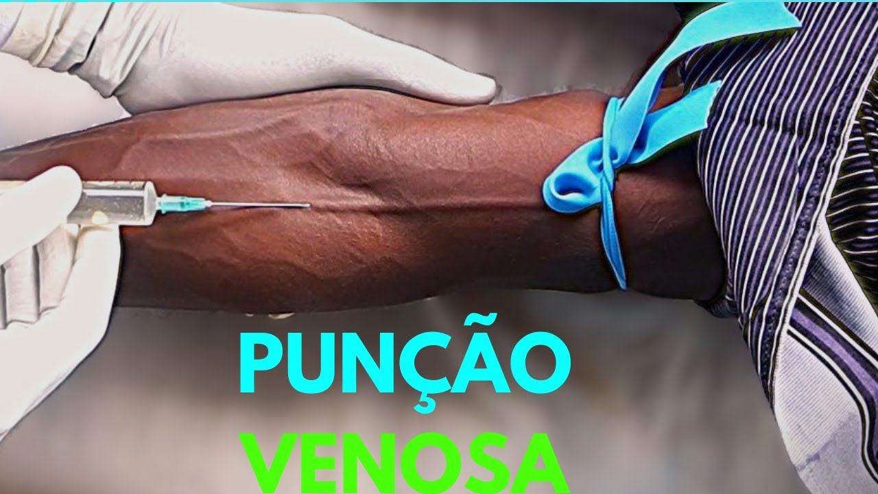 PUNÇÃO VENOSA: Passo a passo pratico - YouTube