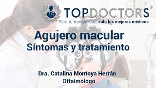 Macular hole: What it is, symptoms, and treatment