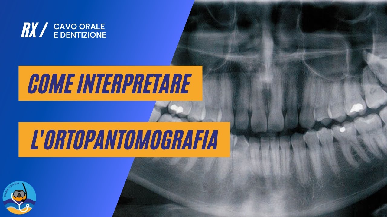 Come interpretare l'ortopantomografia