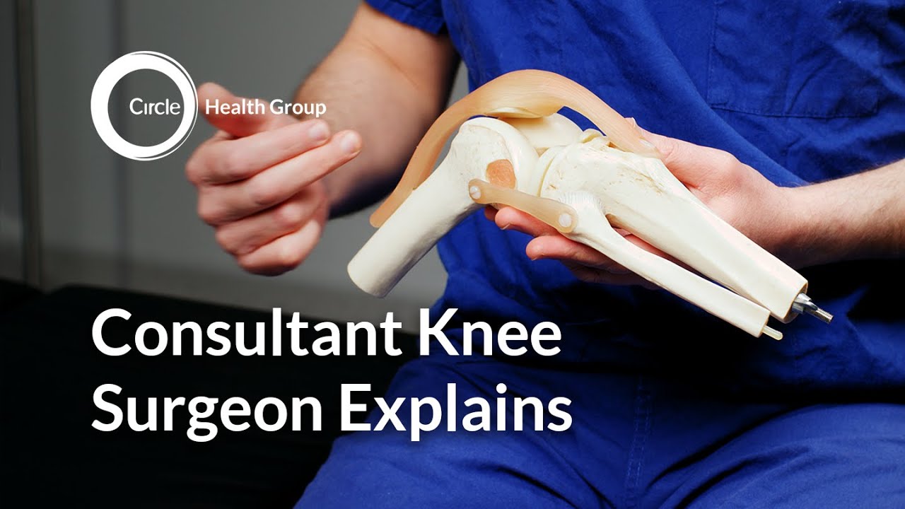 What To Expect From Knee Replacement Surgery YouTube