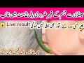 Without threading 👉😱I am surprise how Aunty's beard &amp; mustache removed | facial hair removal at home