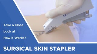 Surgical Skin Stapler: Take a Close Look at How it Works?