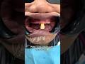 Why His Last Tooth Is SUPER Important! 🦷😬 Mp3 Song