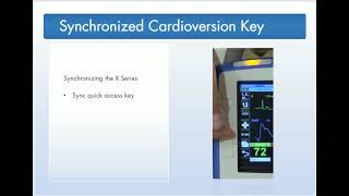 Zoll X Series Synch cardioversion