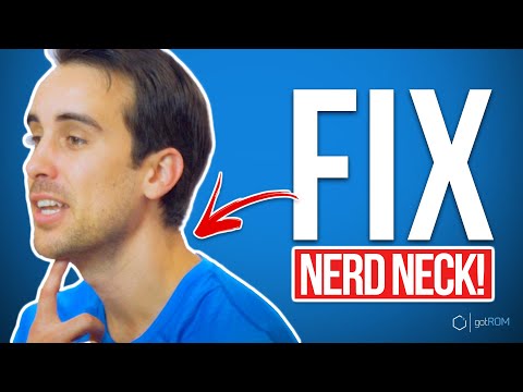 How To Fix "Nerd Neck" | Rounded Shoulders (3-STEP FIX!)