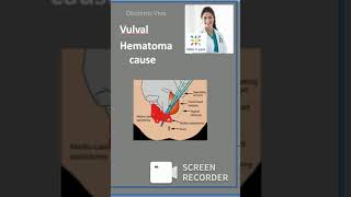 Obstetrics Vulval Hematoma Episiotomy Complication