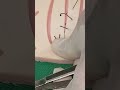 Stitches easy TRICKS 🪡#youtubeshorts #viralvideo #unfrezzmyaccount #otalife