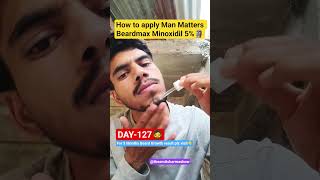 Man Matters Beardmax 5% Minoxidil: Day 127 Results! 😱 #shorts #beard #beardgrowth #viral
