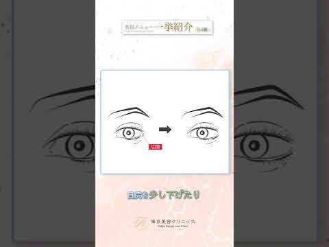 やさしい目元に…『目尻切開』“超” 簡単解説 #美容整形 #東京美容クリニック #Shorts #美容整形 #東京美容クリニック #Shorts