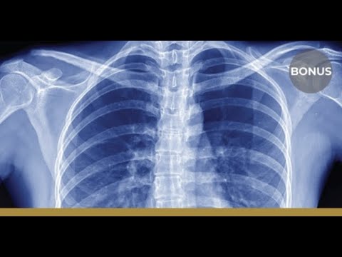 Urgent Care With X Rays Near Me Now