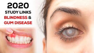 Blindness Linked to Gum Disease (2020 Study)
