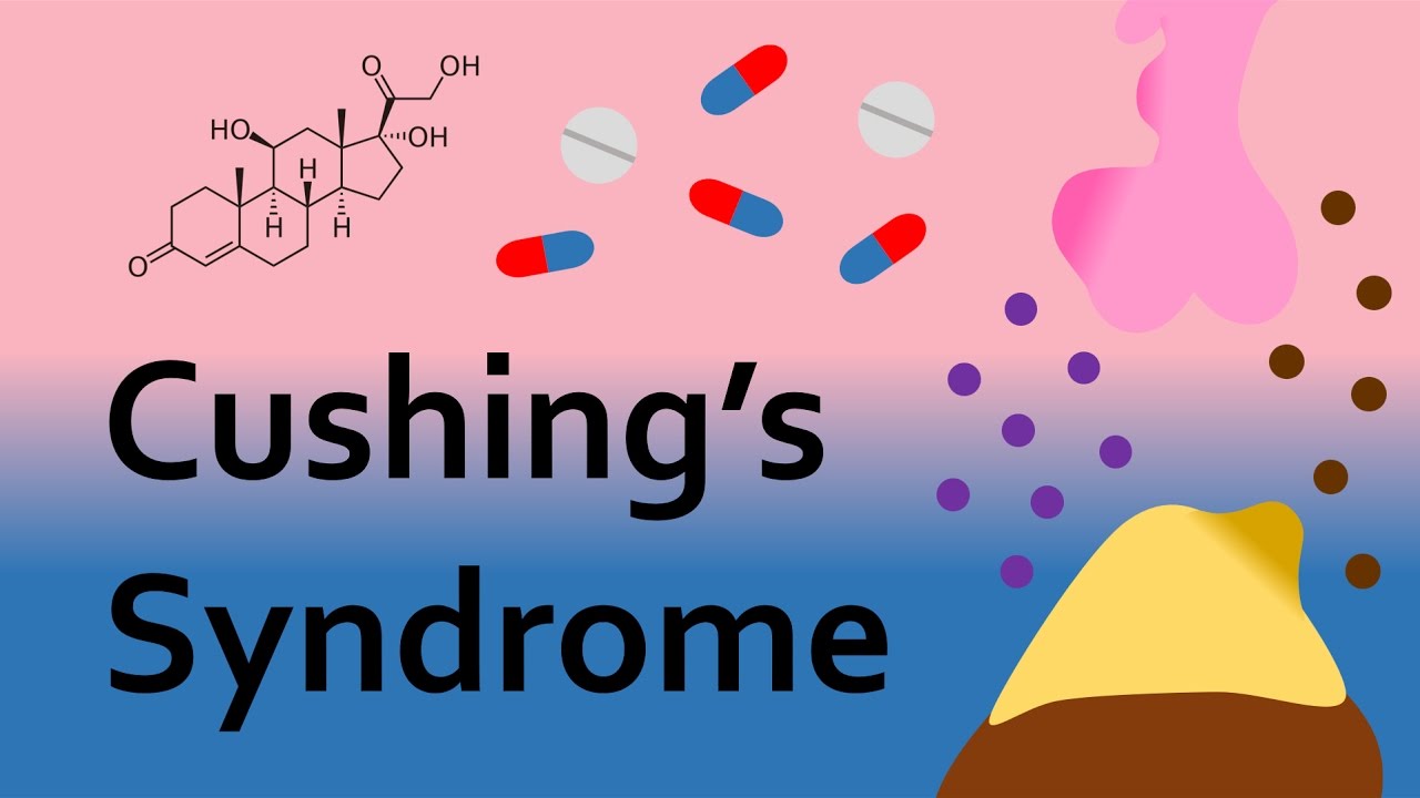 Cushing's Syndrome and Corticosteroids (Part 2) YouTube