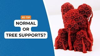 The difference between normal and tree supports Net Worth