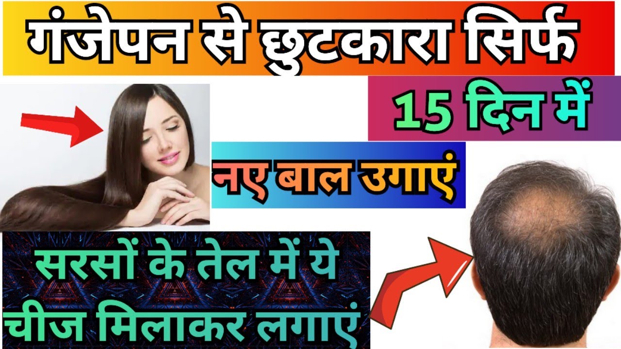 Haw To Grow New Hair Naturally || नए बाल कैसे उगाए || गंजापन कैसे दूर करें || 