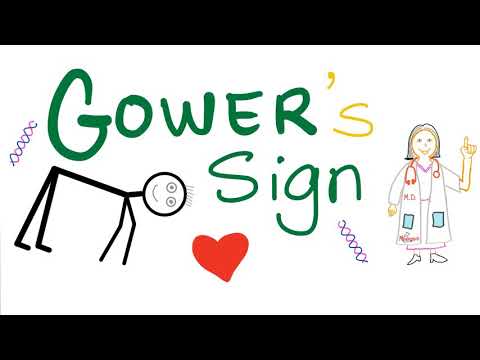 Gower Sign | Duchenne Muscular Dystrophy (DMD) | Signs in Medicine.