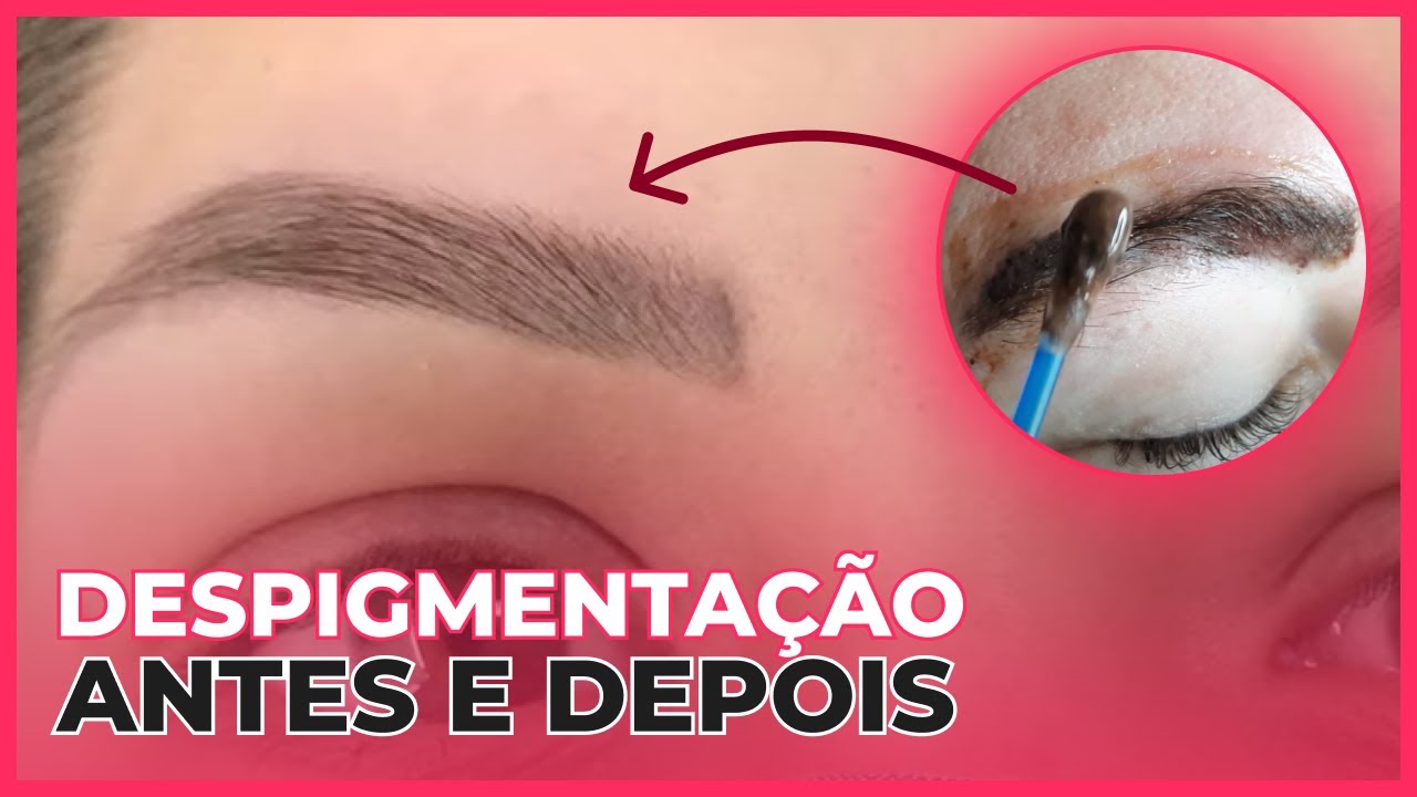 Despigmentação de Sobrancelhas - Antes e Depois - YouTube