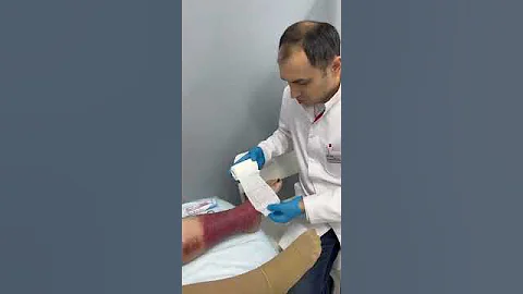 Перевязка ран цинковой повязкой Вароласт. Флеболог Москва.
