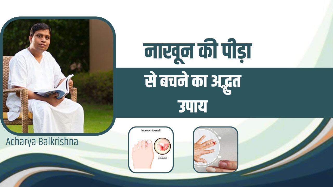 नाखून की पीड़ा (Nail Pain) से बचने का अद्भुत उपाय || Acharya Balkrishna