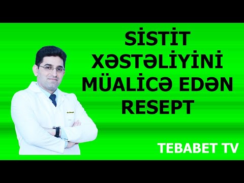 Video: Plastik pəncərələr üçün çarxlar - dəbli və orijinal