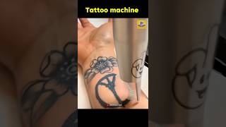 How does a tattoo laser machine work?#shorts