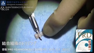 【クインテッセンス出版】結合組織のトリミング――書籍『PRD YEARBOOK 2021』【PRD 発】ケースレポートⅡ（皆川 仁）