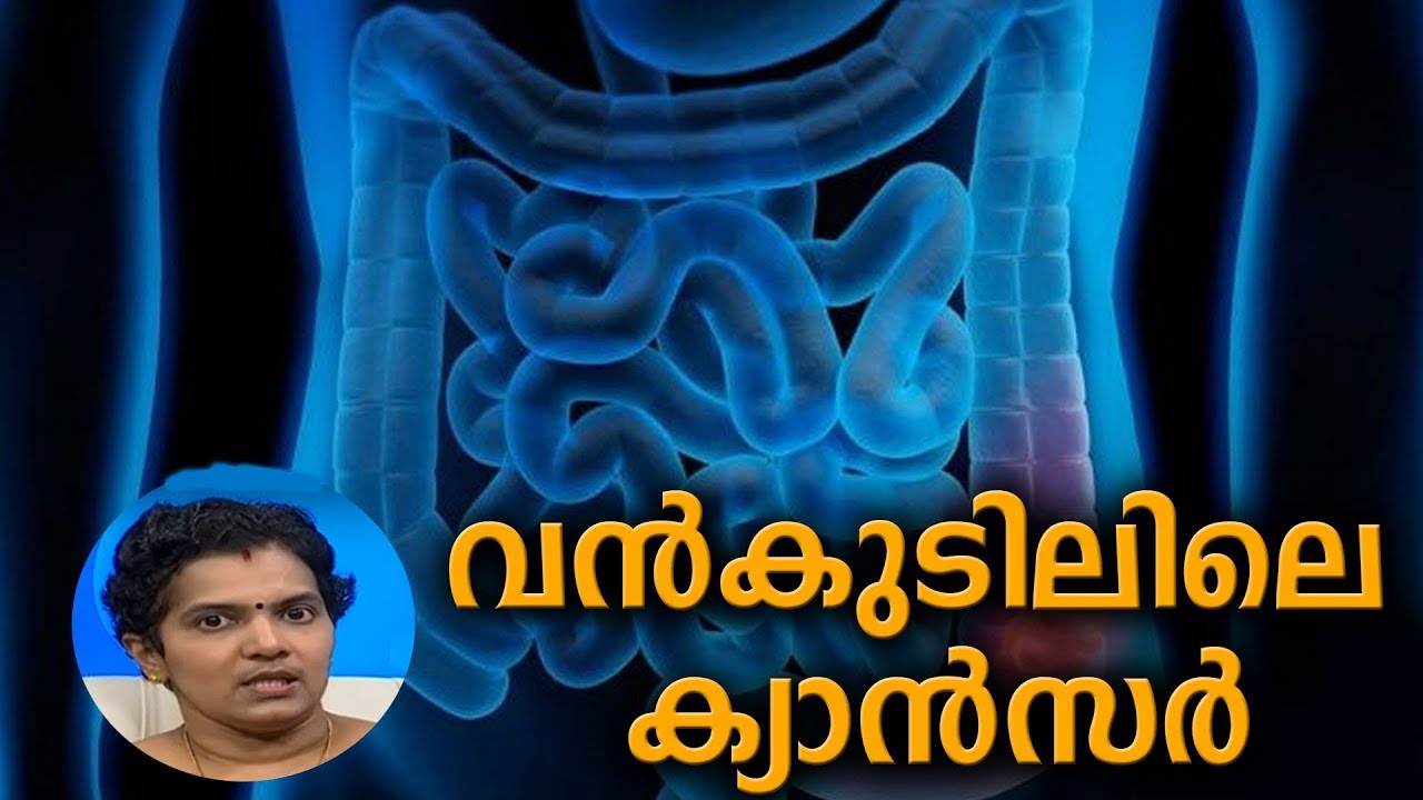 Dr Q : വന്‍കുടിലിലെ ക്യാന്‍സര്‍ | Colon Cancer |  12th March 2019