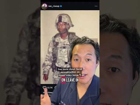 Plastic surgeon explains