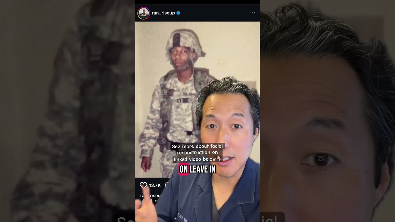 Plastic surgeon explains facial reconstruction!