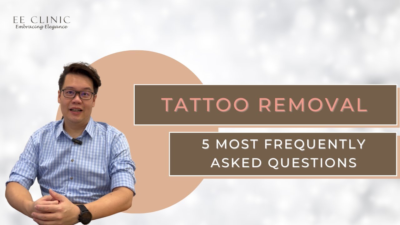 Tattoo Removal | 5 Most Frequently Asked Questions