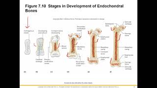 Chapter 7 video 4 slides 17-25 Bone Growth and repair Profile