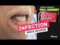 Oral surgery fight club  season 3 episode 1  infection