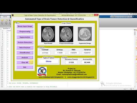 Brain Tumor Detection and Classification of tumor types Using Matlab Code
