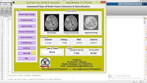 Brain Tumor Detection and Classification of tumor types Using Matlab Code