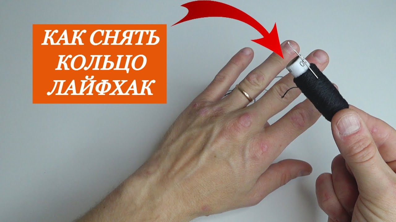 Как снять кольцо с опухшего пальца видео. Инструмент для снятия колец с пальца. Как снять кольцо с помощью нитки. Как снять кольцо с пальца.
